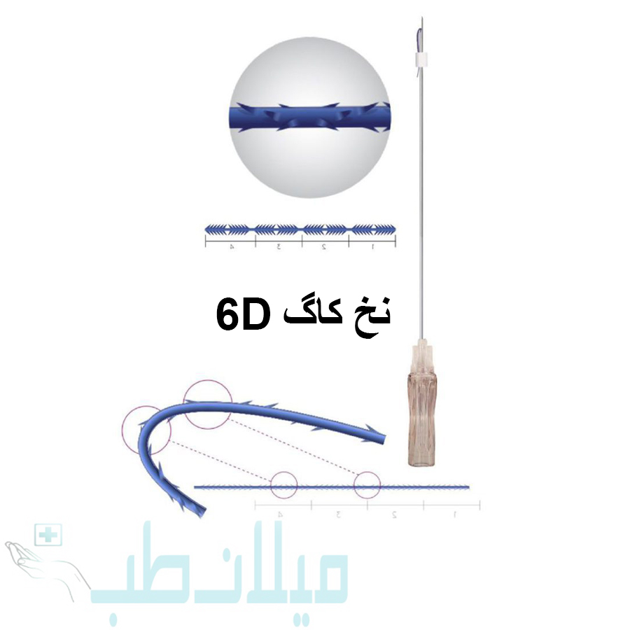 نخ لیفت برند مدیلیفت مدل کاگ 6D سایز G21.60mm