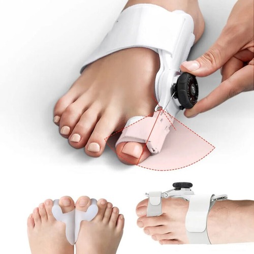 اصلاح کننده هالوکس والگوس پا